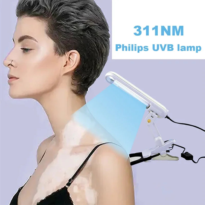 311nm Uvb Phototherapy Narrow Uv Phototherapy Lamp Uvb Light Therapy Psoriasis For Vitiligo