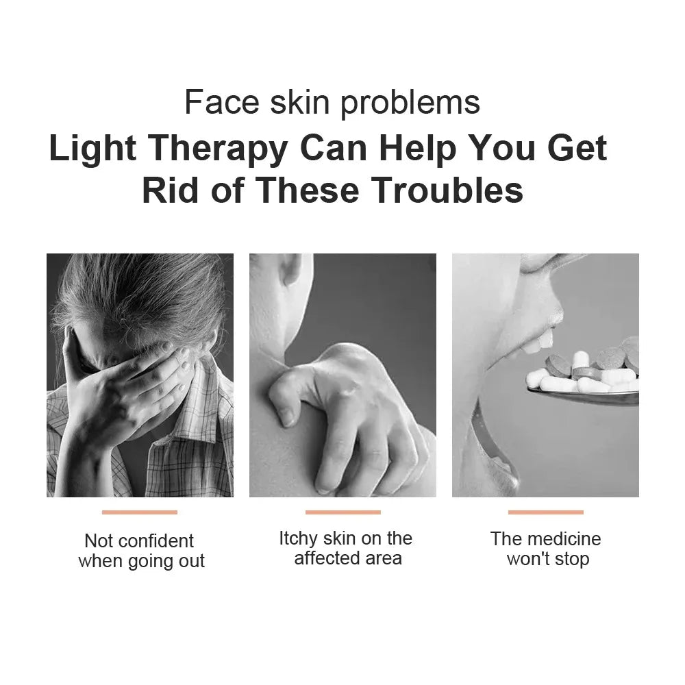 Uvb Lamp Vitiligo Physical Therapy Equipment Narrowband Light Lamp Medical Light Source UV 311nm Therapy For Psoriasis Eczema