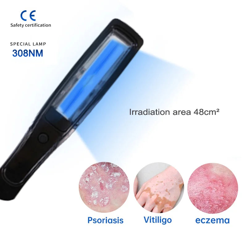Uvb Lamp Vitiligo Physical Therapy Equipment Narrowband Light Lamp Medical Light Source UV 311nm Therapy For Psoriasis Eczema