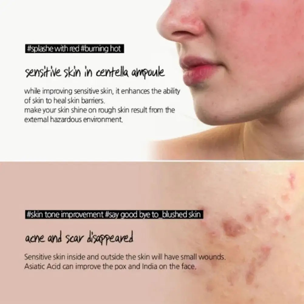 Korean Centella Asiatica Ampoule Serum 100ml