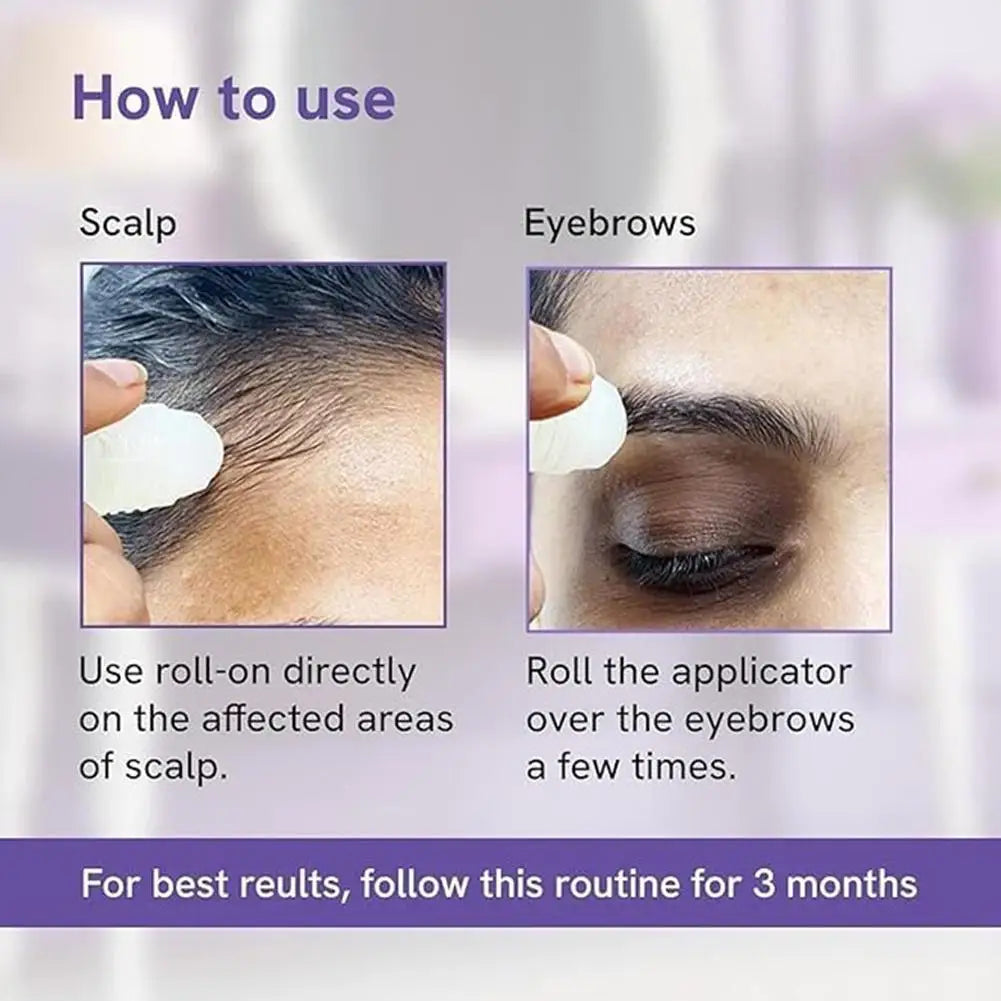 25ml Hair Growth Essence Oil for Hair Care, Scalp Nourishment & Frizz Control 3% Rosemary Hair Serum